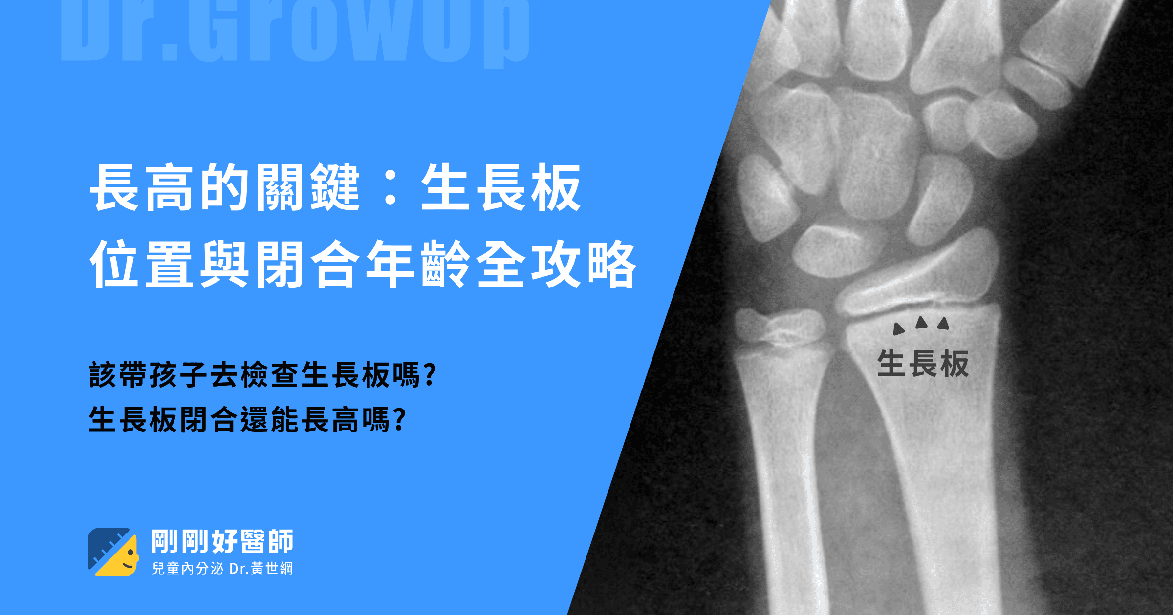 生長板位置與閉合年齡全攻略